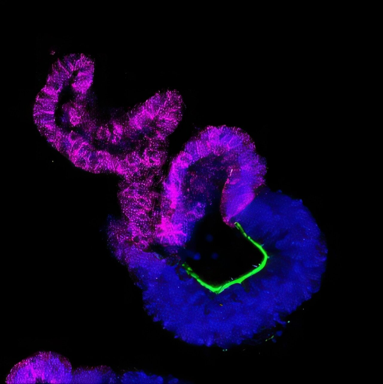 New gene-editing screen maps drivers of early human neural development