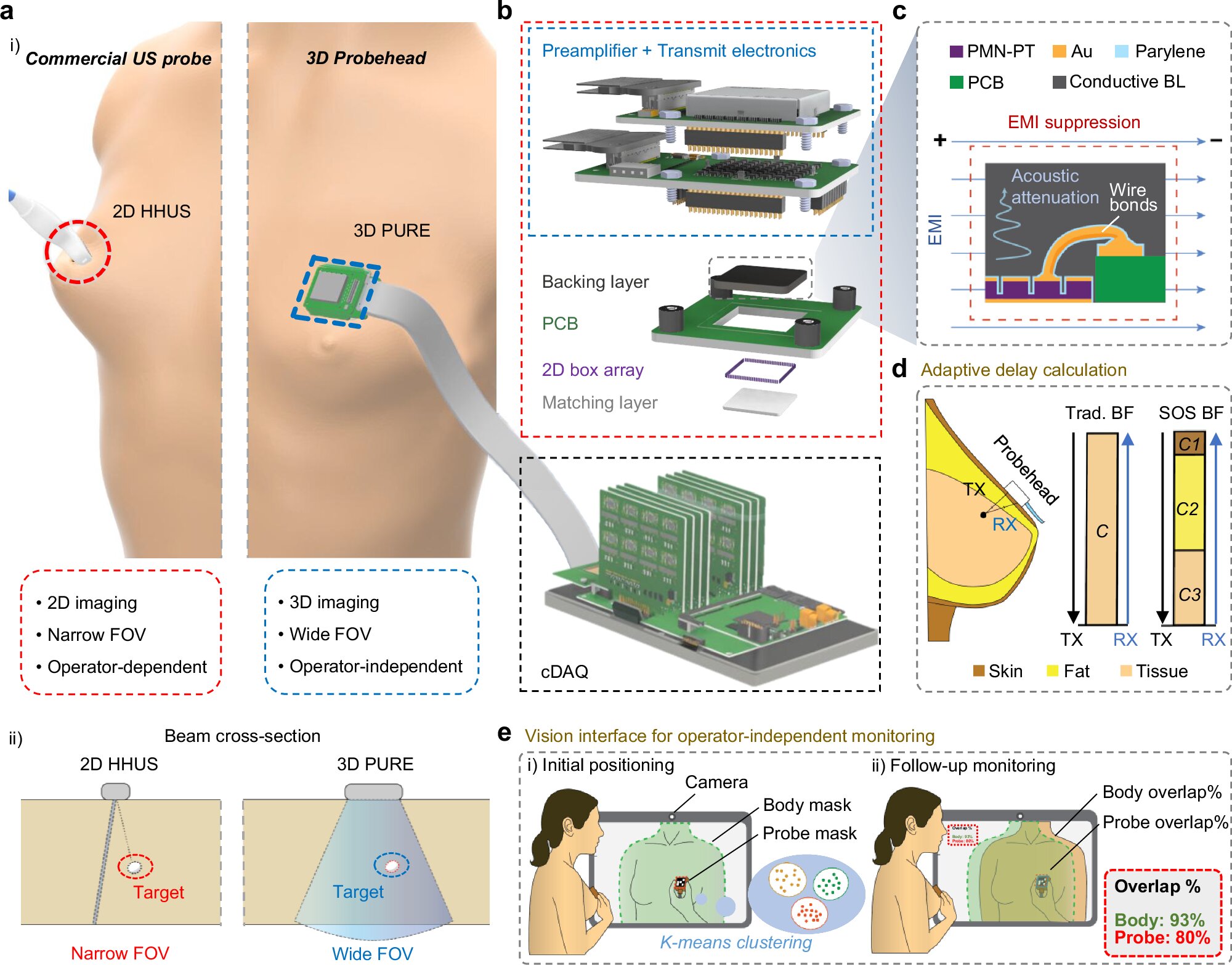 MIT team improves portable 3D ultrasound for breast imaging
