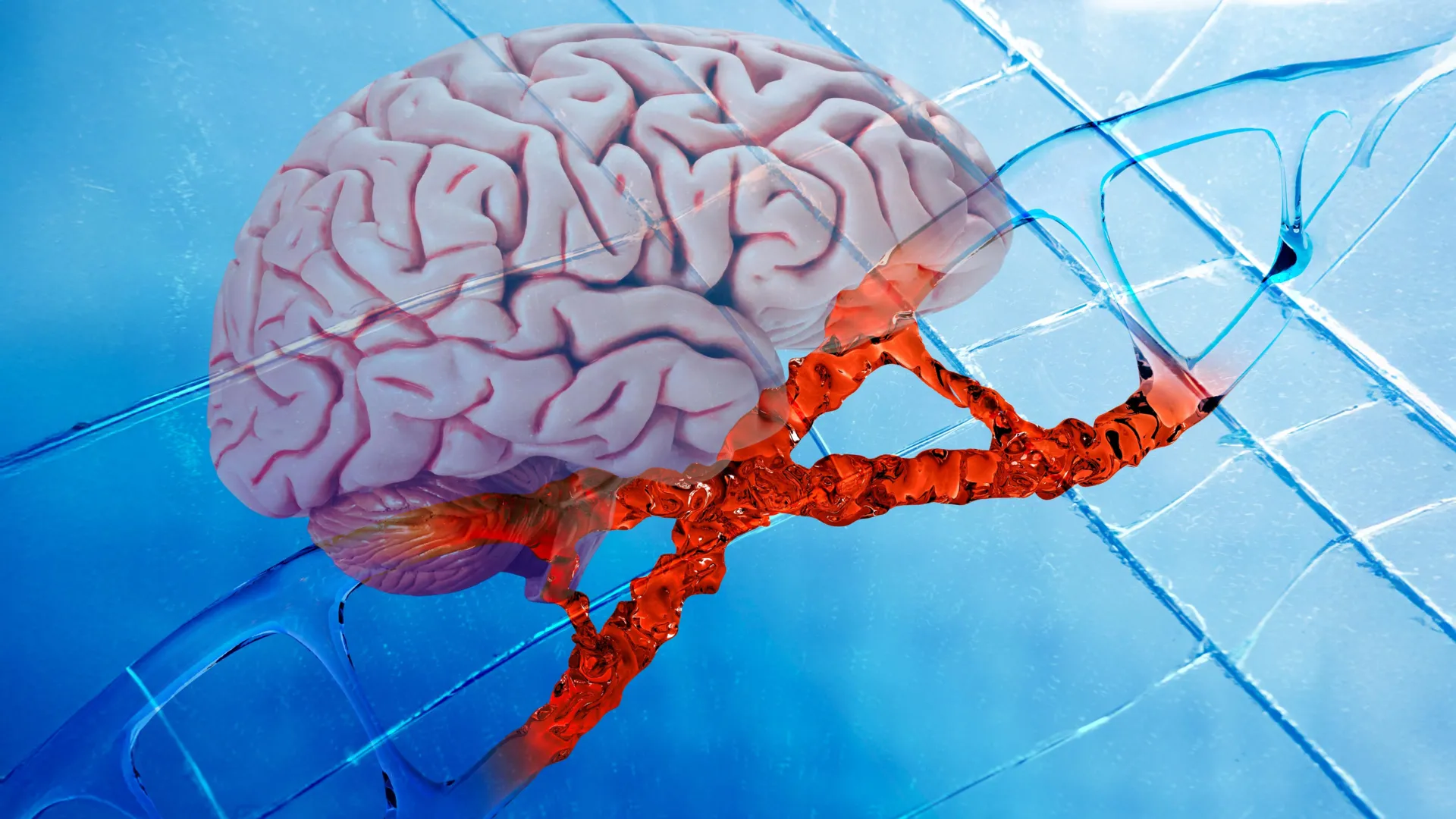 Spinal injury drug shows Alzheimer’s effects in mouse study