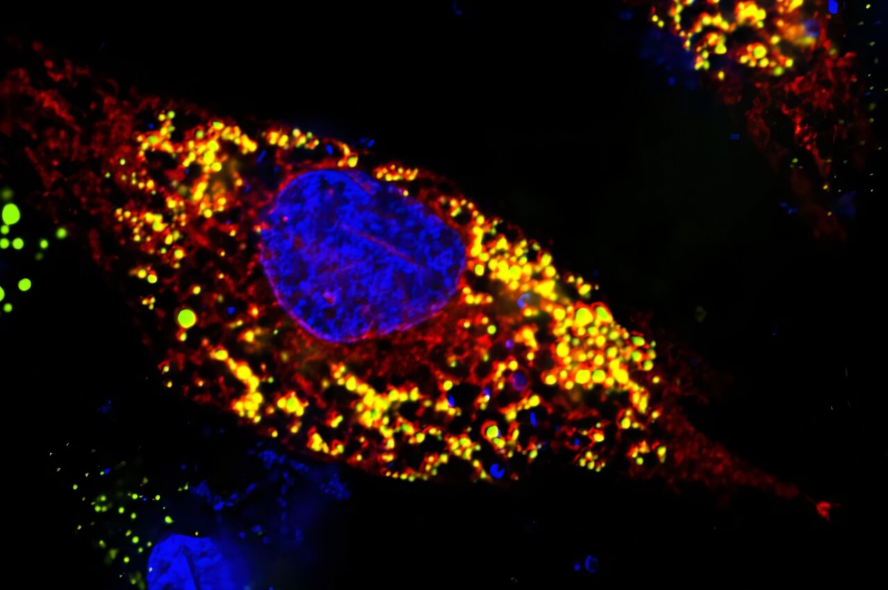 Lipid droplet antiviral defense may point to broad-spectrum virus drugs