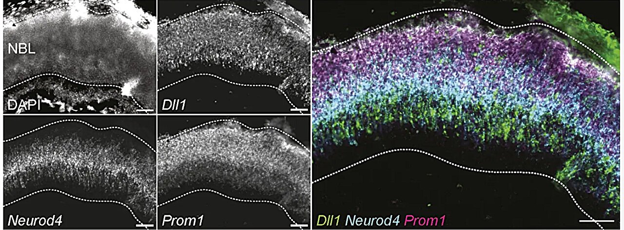 Penn researchers identify retinal cell stages that could improve transplants