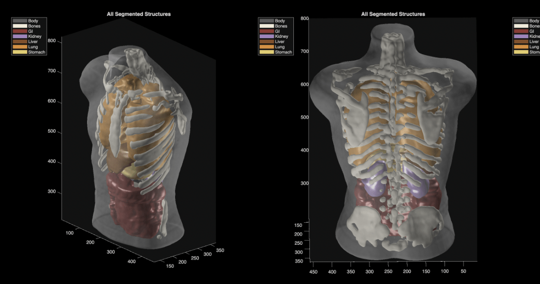 Midjourney shows ultrasound scanner as its first hardware product