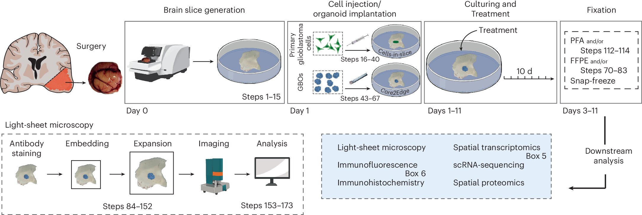 Core2Edge glioblastoma model maps tumor spread in human brain tissue