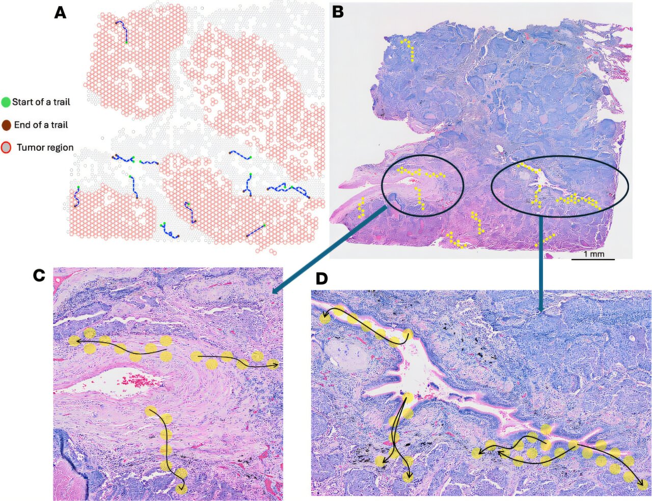 Researchers map T cell movement inside tumors with new computational tool